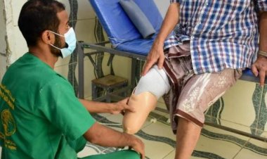 مركز الأطراف الصناعية في عدن يخدم 224 مستفيدًا