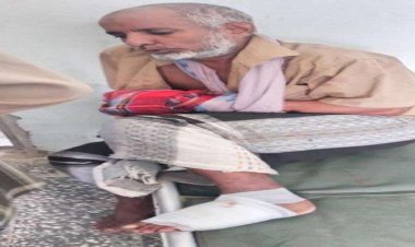 إصابة مواطن وطفله بانفجار أحد مخلفات الحرب في لحج