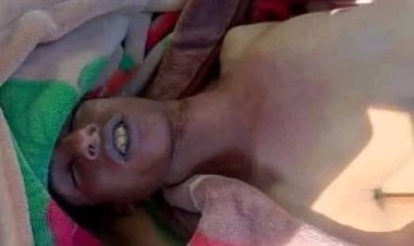 شاب ينهي حياته شنقًا في تعز اليمنية وسط ظروف غامضة