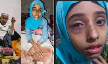 مُسن يُقدم على ضرب طفلة بشكل وحشي عقب شجارها مع حفيده